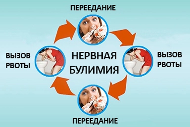 Лечение булимии в Сибирском